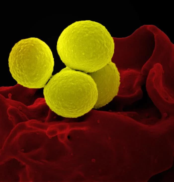 Scanning electron micrograph of intestinal bacteria relevant to gut barrier dysfunction in malnourished infants