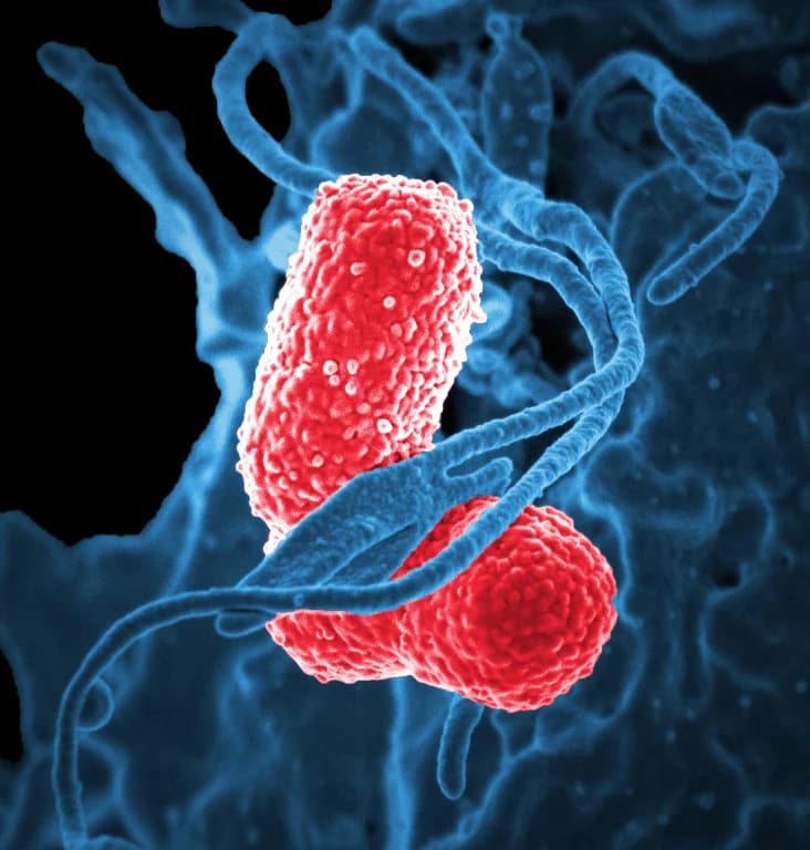 Scanning electron micrograph of oral bacteria associated with oral cancer research